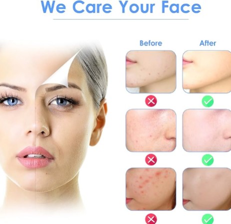 Luminus Style Skin Scrubber – Συσκευή Καθαρισμού & Απολέπισης με Υπερήχους