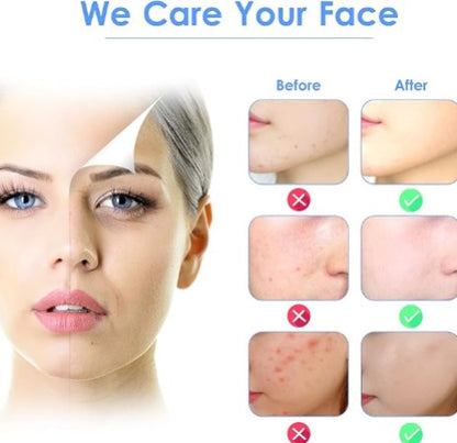 Luminus Style Skin Scrubber – Συσκευή Καθαρισμού & Απολέπισης με Υπερήχους